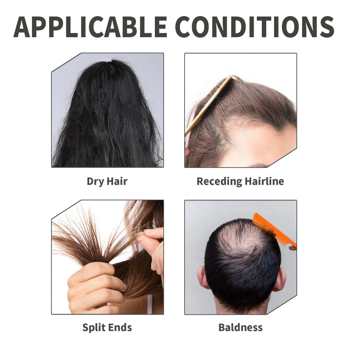 Hair Growth Spray Rice Water Fast Growing Prevent Alopecia Repair Dry Frizzy Damaged Nourish Roots Smooth Scalp Treatment Serum