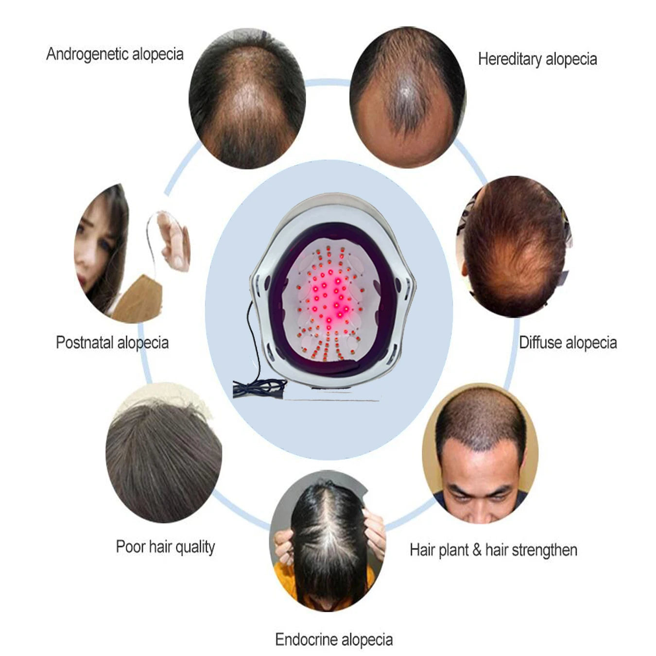 Red Light Laser Hair Growth Helmet for Anti hair loss laser hair regrowth therapy