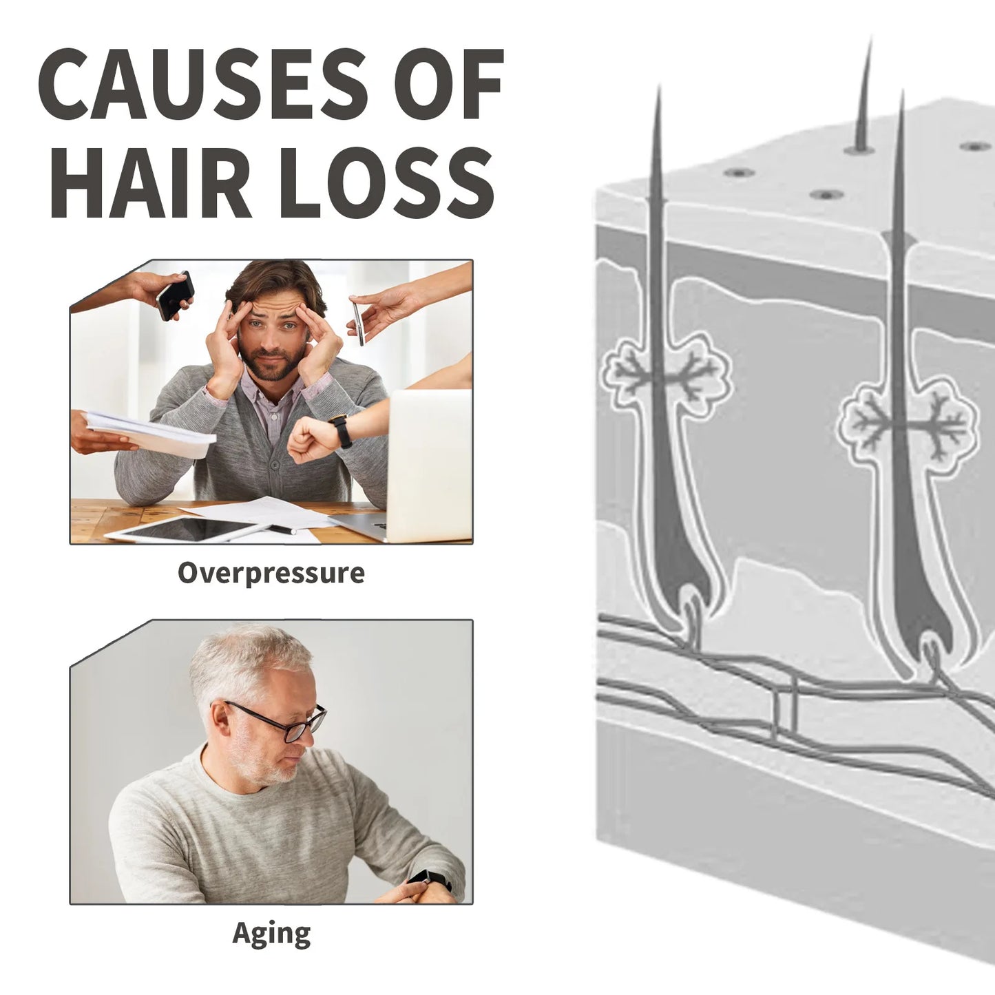 Hair Growth Spray Rice Water Fast Growing Prevent Alopecia Repair Dry Frizzy Damaged Nourish Roots Smooth Scalp Treatment Serum