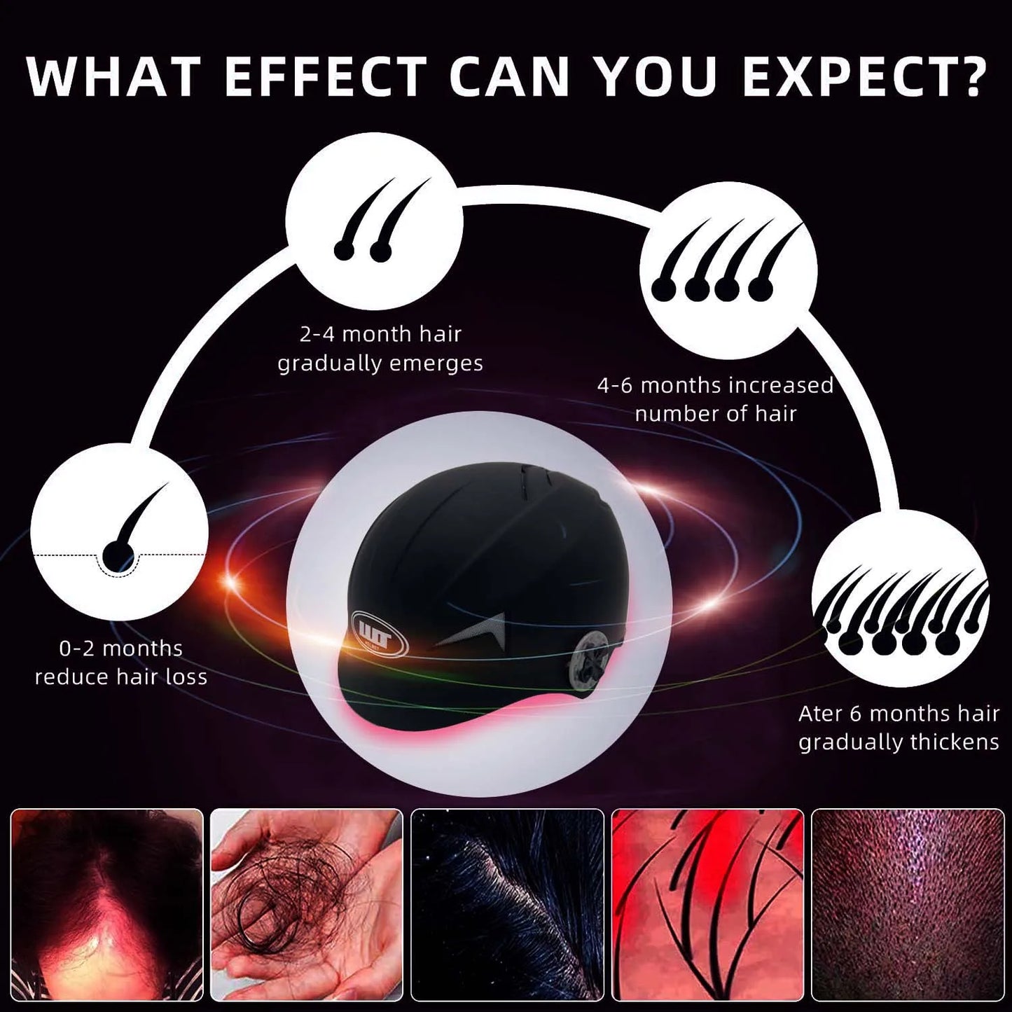 Red Light Laser Hair Growth Helmet for Anti hair loss laser hair regrowth therapy